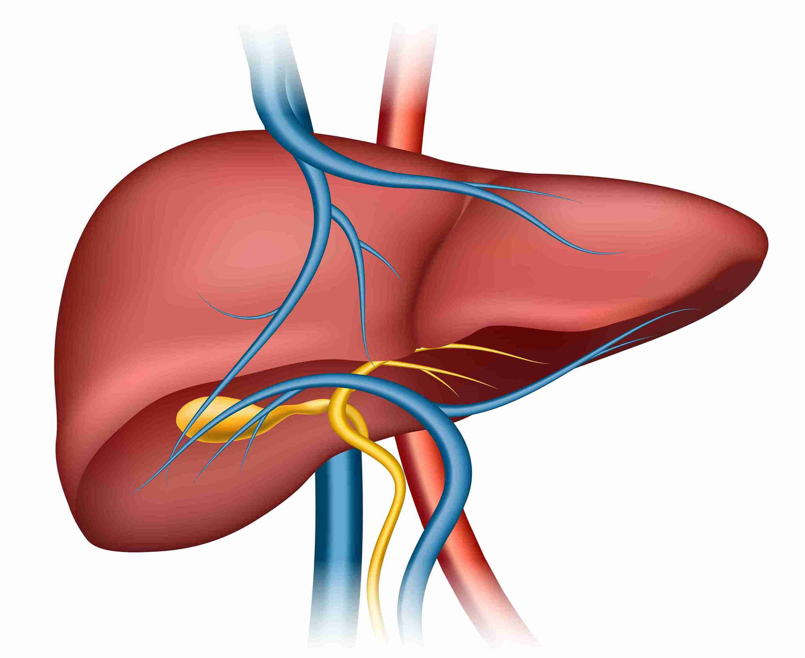 pyogenic liver abscess