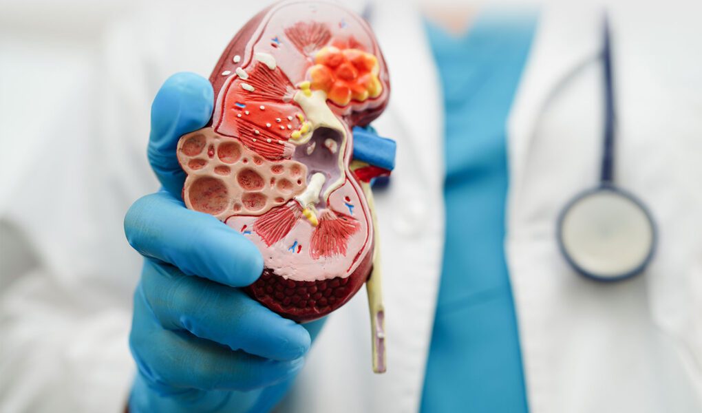 chronic kidney disease