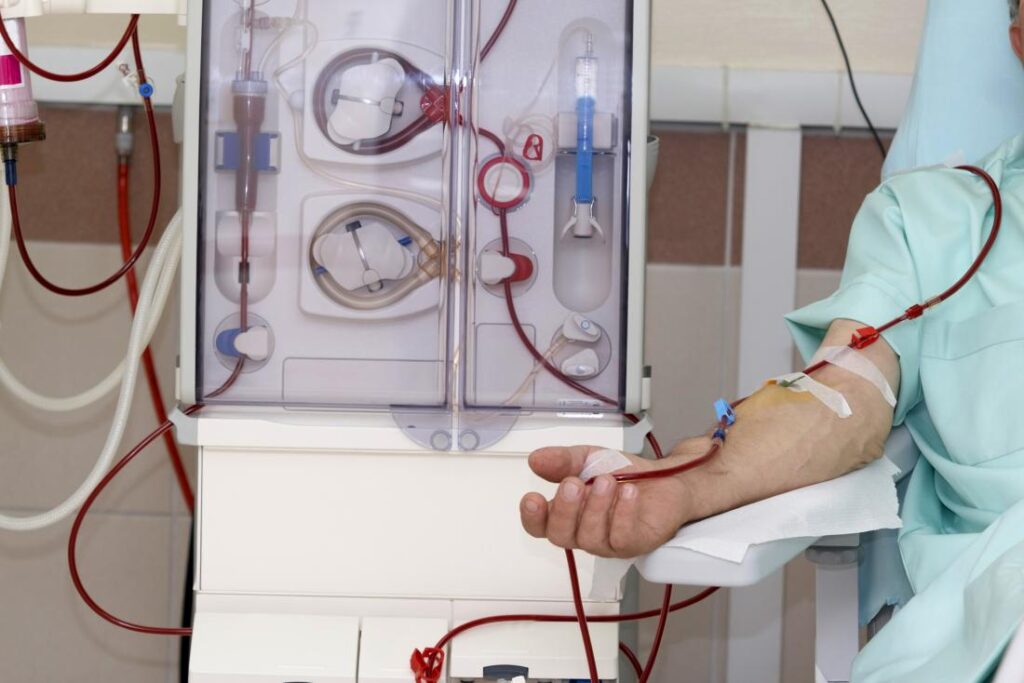 haemodialysis for chronic kidney disease