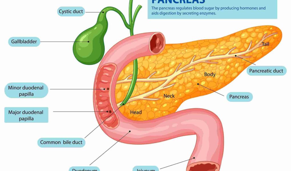 Pancreatitis