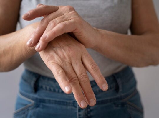 rheumatoid arthritis