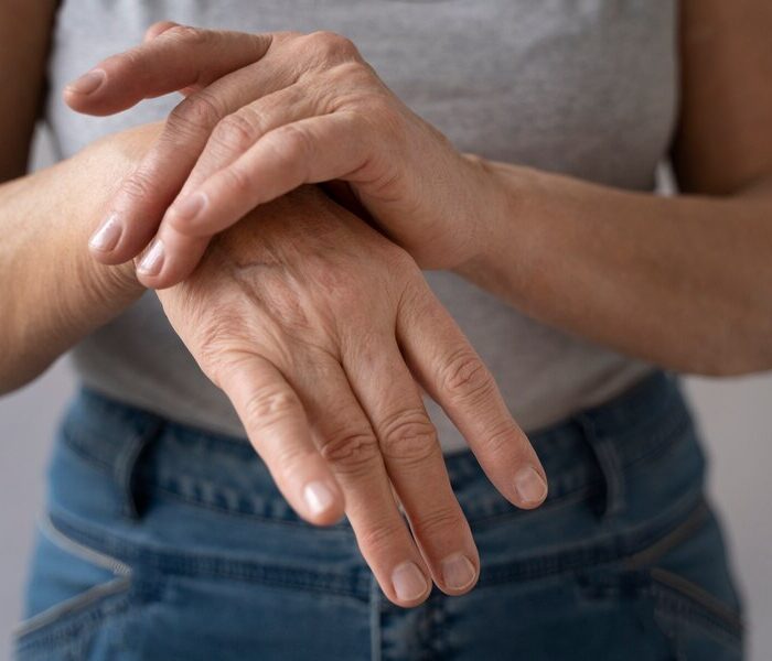 rheumatoid arthritis